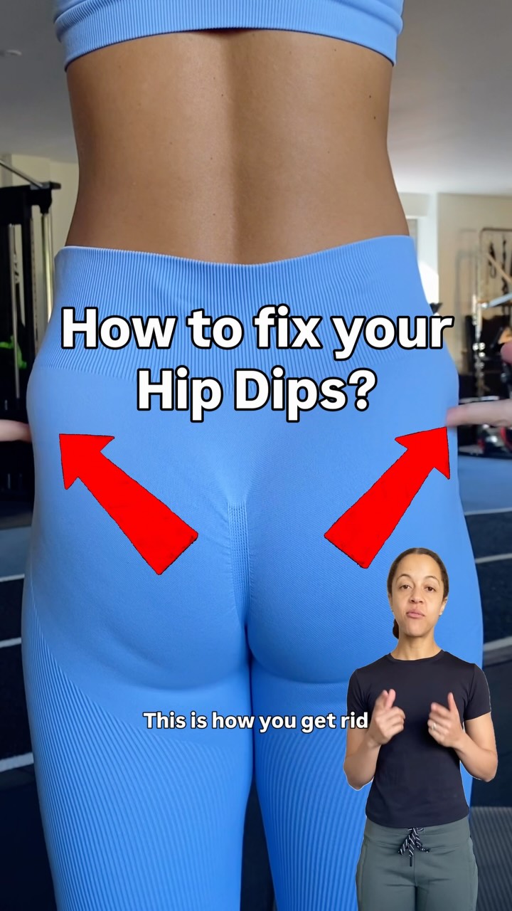 So hip dips are often something I look for when assessing clients for….well, most things. Back pain, hip impingement, diastasis recti, posture. They’re relevant for a whole lot more than just butt shape. And the real fun is when it’s just one-sided! 

It’s something I’ve touched on in other posts, but it often comes with a pelvis that’s tucked under; people who chronically clench their glutes; and those locking into their pelvis because of deeper abdominal and core weakness. 

I like to hold this position for up to 10 slow breaths and then move in and out of it for 10 reps. 

This is just one of the exercises I tend to go to, but there are so many other good ones. Do you have any favourites?

#pelvicphysio #gluteworkout #bbl #gluteexercise #bootyworkout